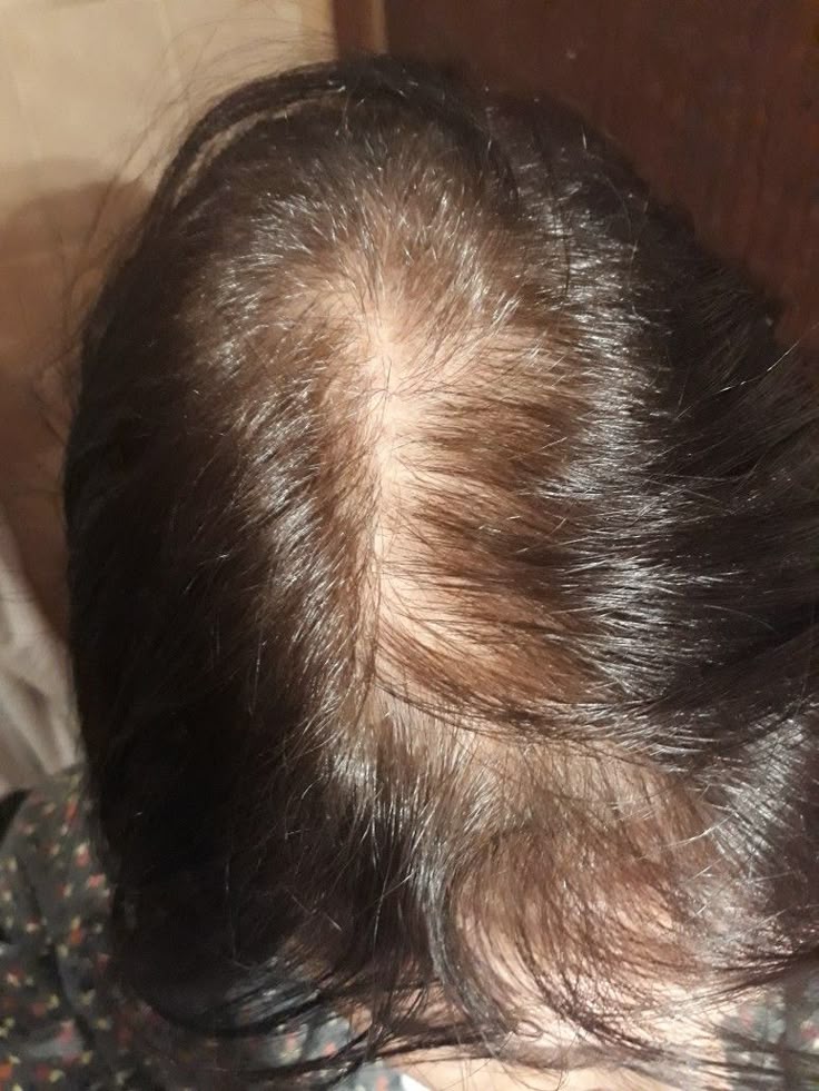 Frizz & Weak Hair: How Natural Oils Restore Strength